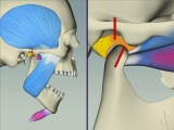 open and close jaw motion