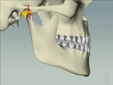 anterior guidance