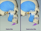 stable destructive comparison