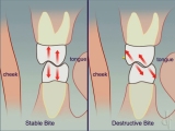 molar contacts comparison