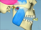 anterior splint orthotic for teeth