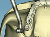 equilibration