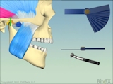 leaf-gauge equilibration