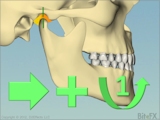 jaw slide and 1 degree rotation