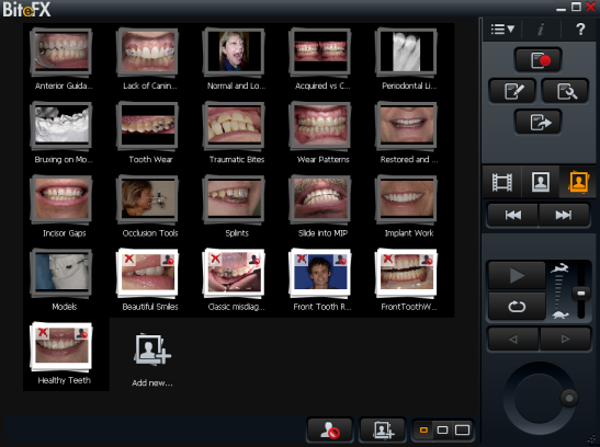 Add your own photographs using the BiteFX picture editor