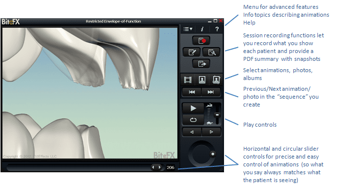 BiteFX makes it easy to explain the bite