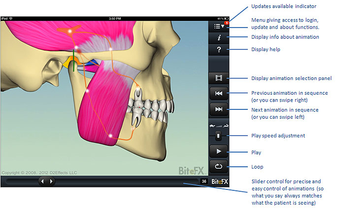 BiteFX makes it easy to explain the bite