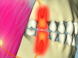 interference effects sensitive painful teeth
